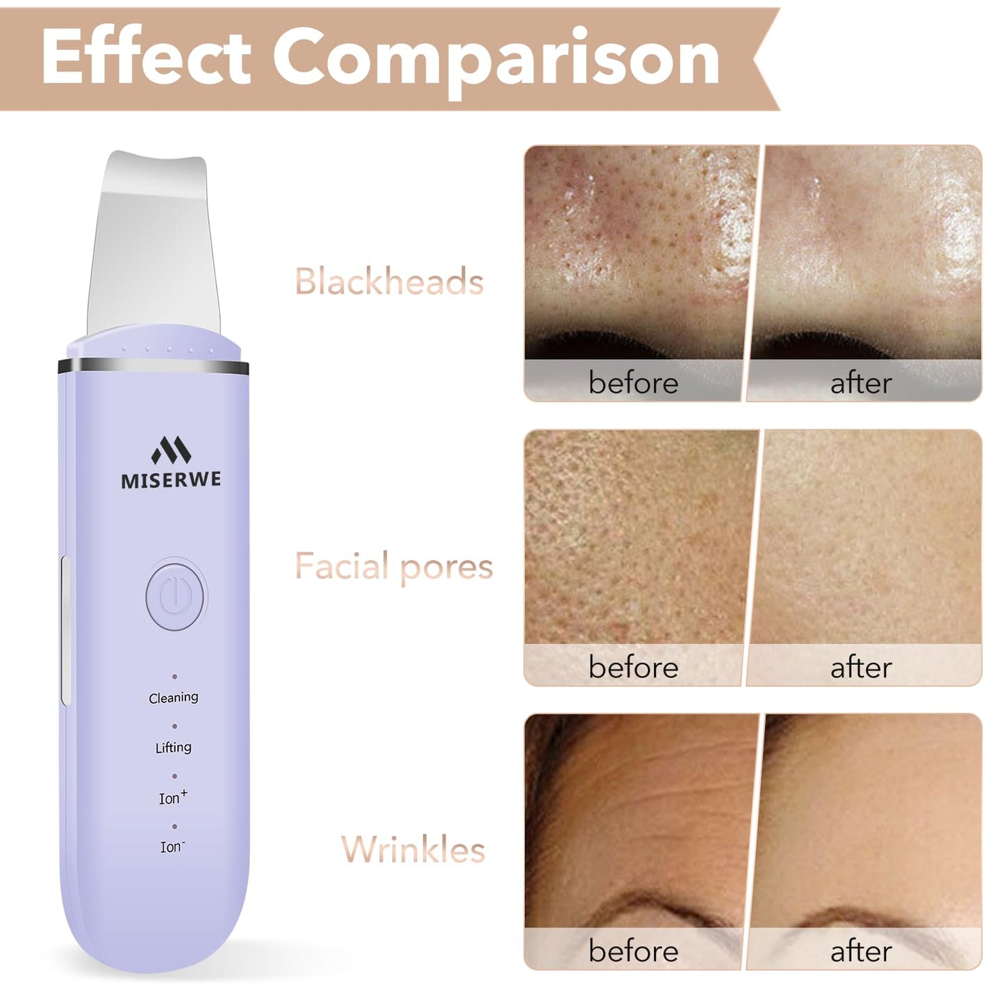 Skin Scrubber Face Skin Spatula Facial Scrubber Spatula