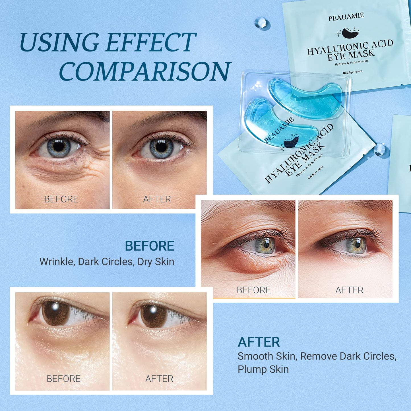 PEAUAMIE Under Eye Patches Gold and Hyaluronic Acid for puffy eyes