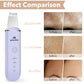 Skin Scrubber Face Skin Spatula Facial Scrubber Spatula