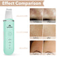 Skin Scrubber Face Skin Spatula Facial Scrubber Spatula