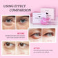 PEAUAMIE Under Eye Patches Gold and Hyaluronic Acid for puffy eyes