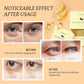 PEAUAMIE Under Eye Patches Gold and Hyaluronic Acid for puffy eyes